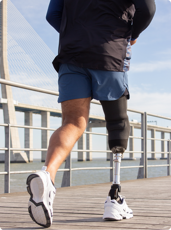 Person with prosthetic leg